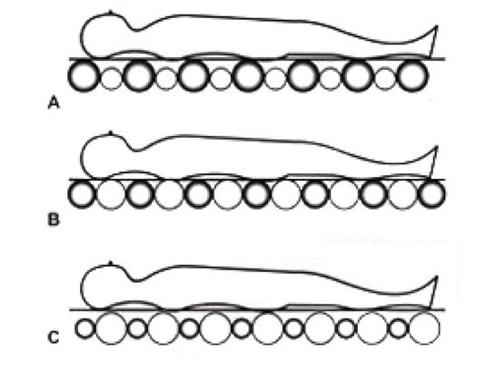 Materasso medico antidecubito
